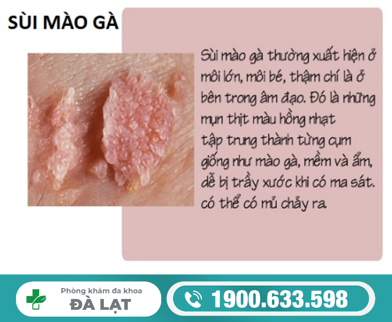 Hình ảnh minh họa
